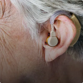 Hearing Aid Fitting Lab with Speech Mapping