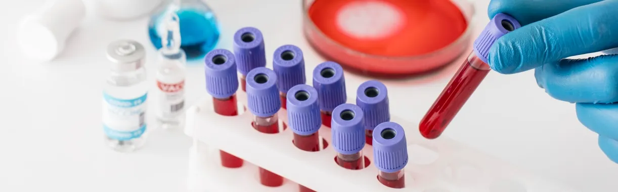 Blood Vials